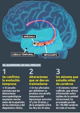 cientificos-valencianos-descubren-los-cambios-que-se-producen-en-un-cerebro-con-alzheimer-años-antes-de-que-aparezcan-los-sintomas